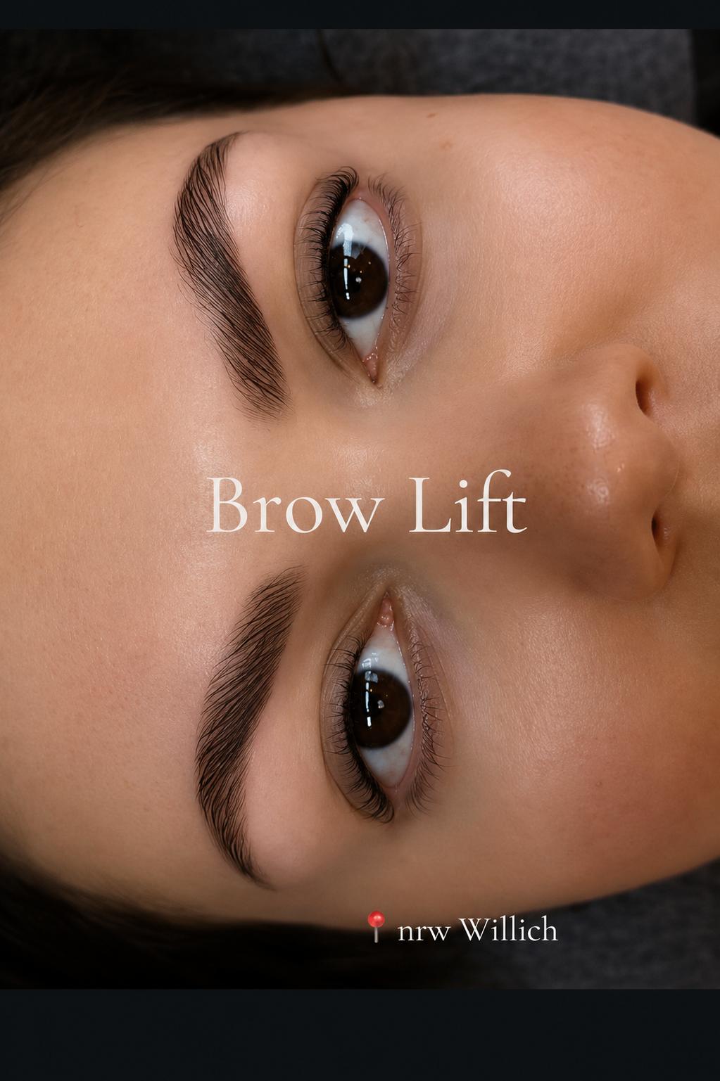 Brow Lift Ergebnis